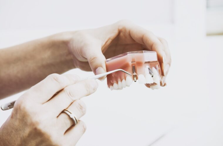 A full set of dentures resting on a clinical work surface