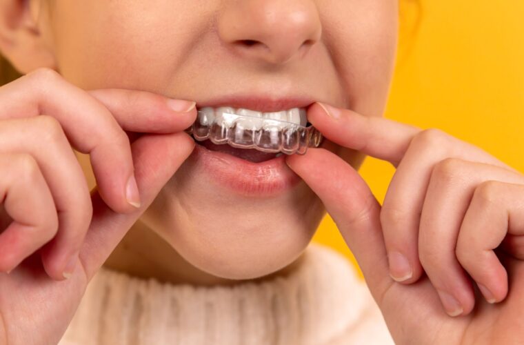 A clear removable orthodontic aligner