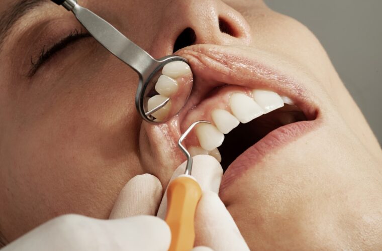 A dentist carrying out an oral examination during a routine visit
