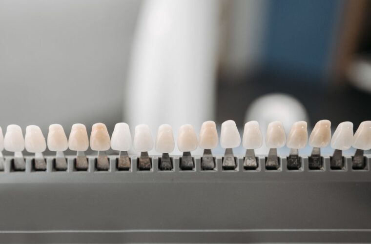 A close view of a smile after cosmetic dental treatment